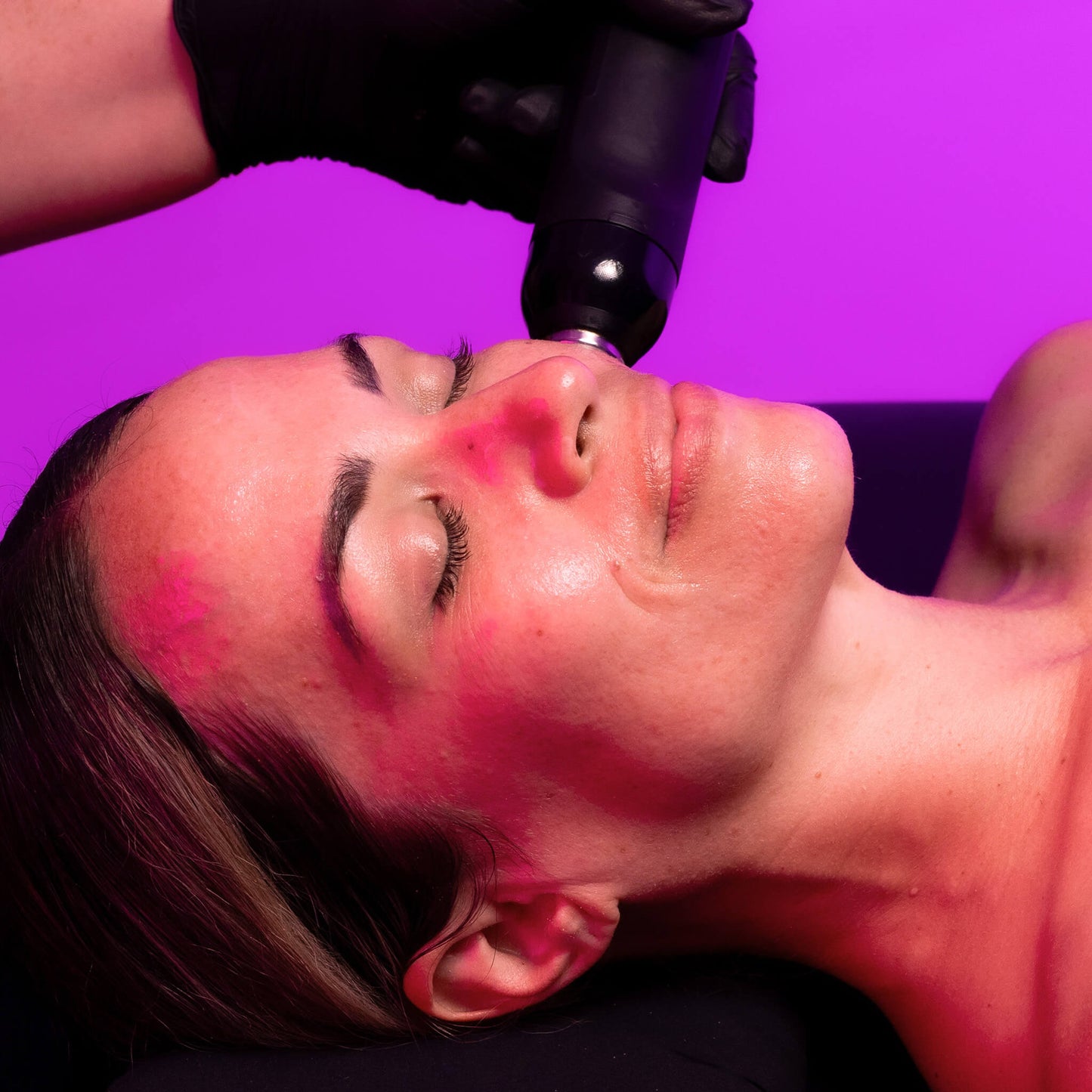 Exofirm Model Ultrasound